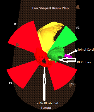 Fan Shaped Beam Planning display