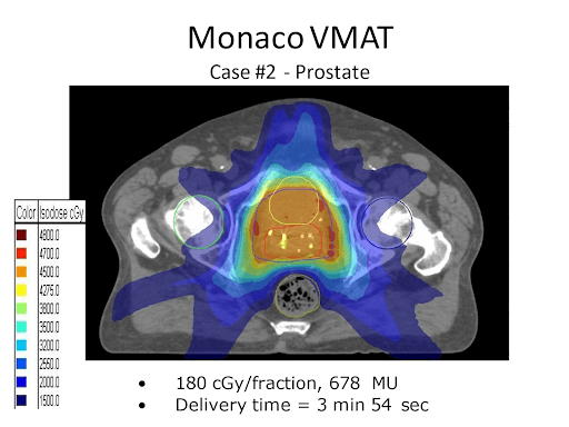 Monaco VMAT Case 2