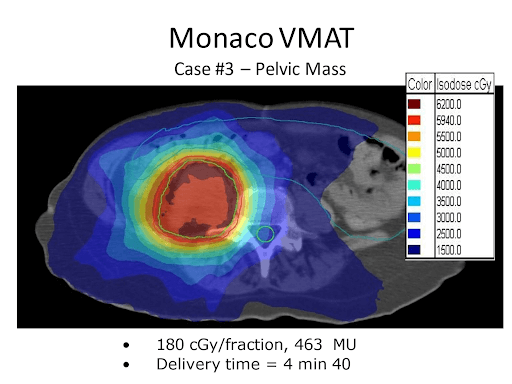 Monaco VMAT Case 3