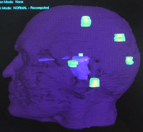 NCCI Clinical & Radiation Oncology Case Reports